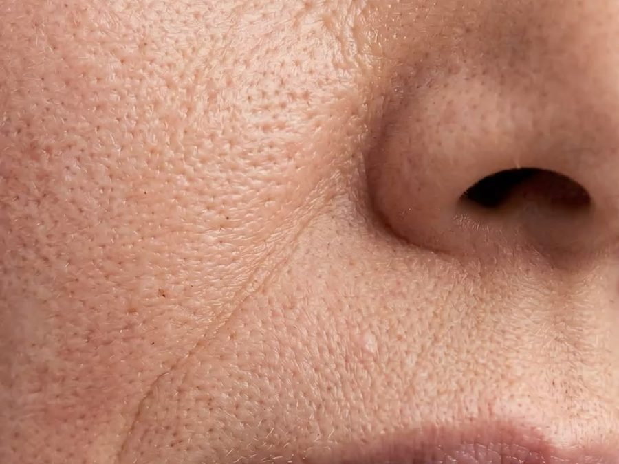 Gros plan de la texture de la peau et des pores
